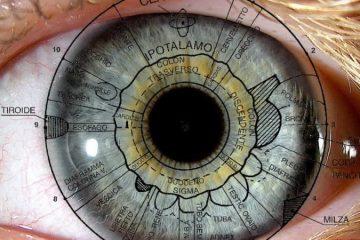 Iridologia Mostoles